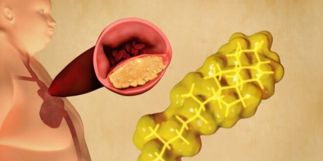 «Κακή» χοληστερόλη: Πόσο επικίνδυνη είναι τελικά για τα καρδιαγγειακά;