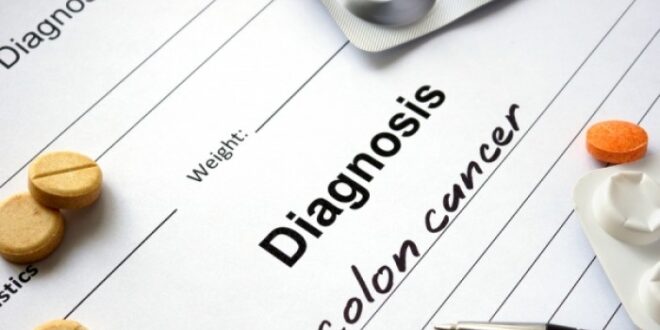 Καρκίνος παχέος εντέρου: 5 παράγοντες που αυξάνουν τον κίνδυνο σε άτομα κάτω των 40 ετών