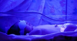 Μωρά με ίκτερο: Ποιο θανάσιμο κίνδυνο κρύβει η φωτοθεραπεία