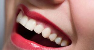 Αυτές οι τροφές κάνουν τα δόντια πιο λευκά