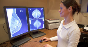 Ακρίβεια 99% στην διάγνωση καρκίνου του μαστού, με την ψηφιακή τομοσύνθεση