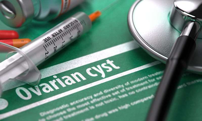 Σύνδρομο πολυκυστικών ωοθηκών Η τροφή που προστατεύει από τις επιπτώσεις