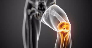 Θεραπεία γόνατος με βλαστοκύτταρα σε νεαρό αθλητή