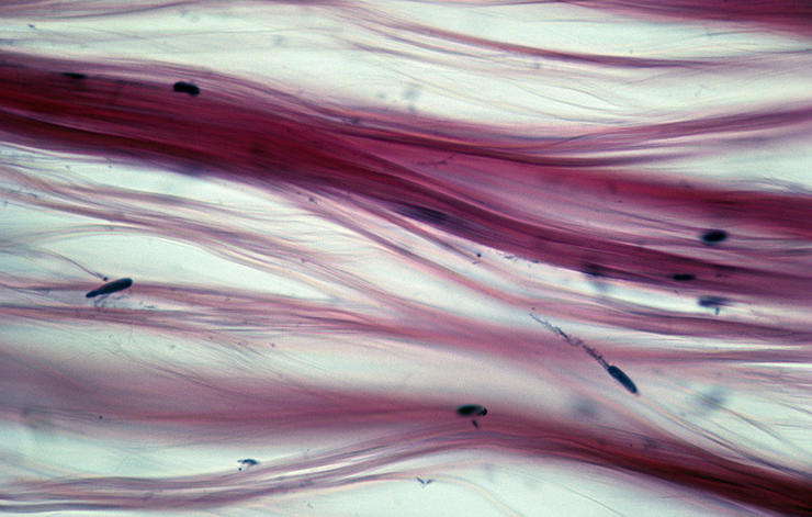 gettyimages 139804245 fibrous tissue ed reschke 0