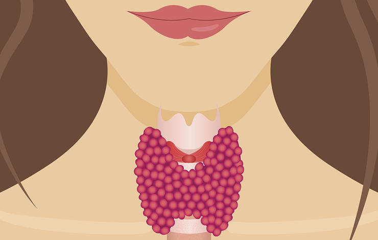 gettyimages 578582212 nauma thyroid