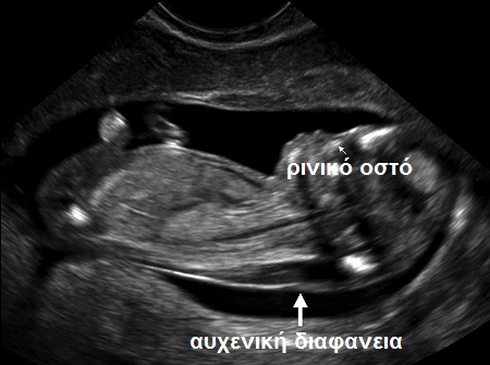 ---------------------------------------------------------------------------------------------------------------------------------Εικόνα 4 3