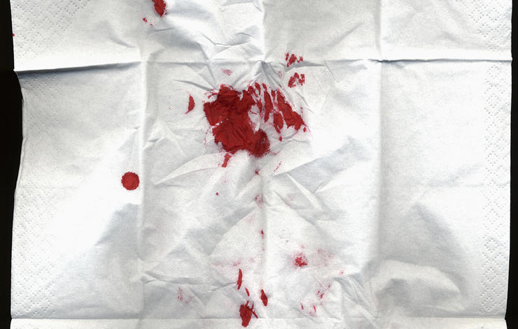 gettyimages 108914538 blood martin hospach