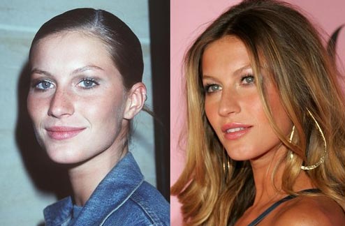 Gisele Bundchen Nose Job