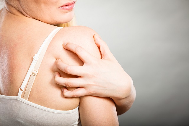 bigstock Woman Scratching Her Itchy Bac 179399638
