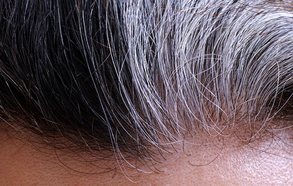 grey hair