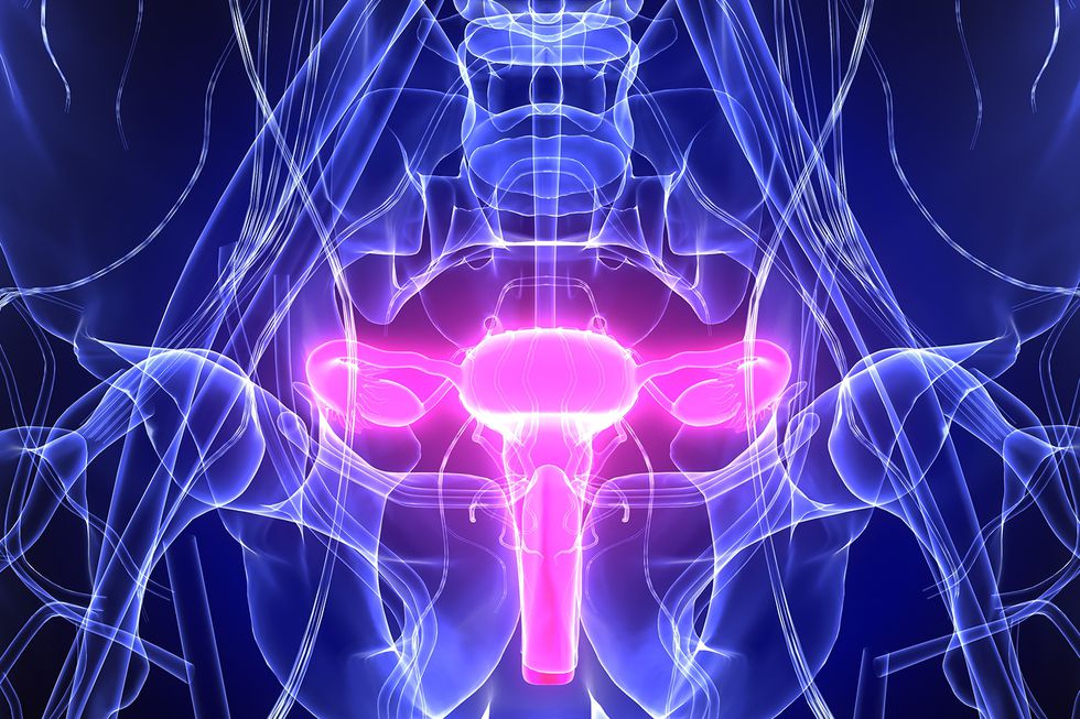 ovarian cancer