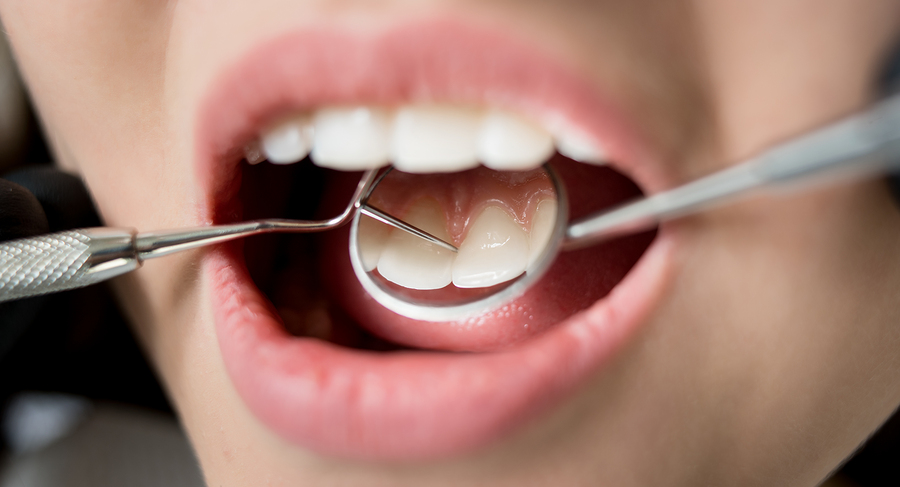 mouth 3