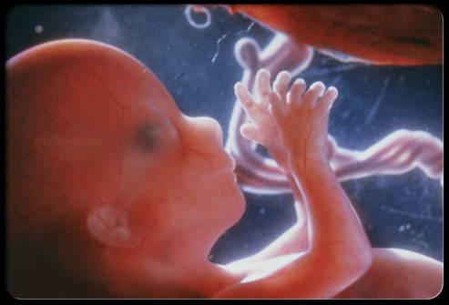13preg