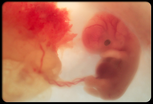 8preg