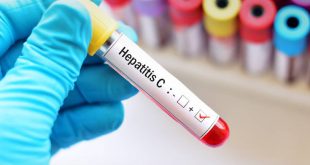 Σε ποια νοσοκομεία μπορείτε να εξεταστείτε για ηπατίτιδα C