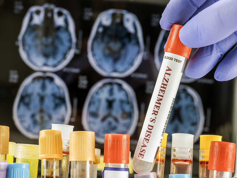 bigstock Scientist Holds Blood Sample T 280520791