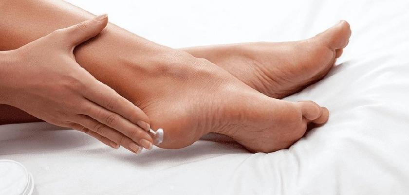 cracked heels