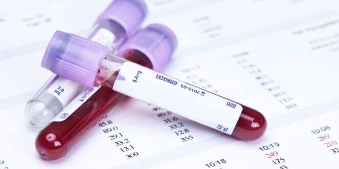 Εξέταση αίματος αποκαλύπτει εγκαίρως τον κίνδυνο εμφάνισης σήψης