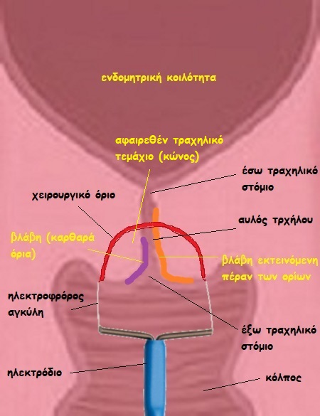 eikona 3