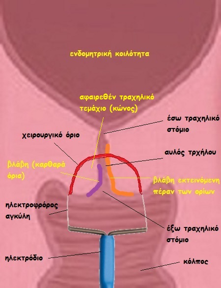 eikona 3