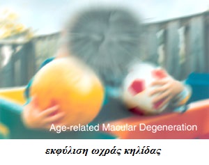 ekfulisi wxras kilidas