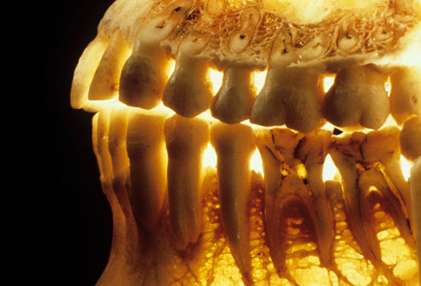 3photoresearchers rm photo of teeth and- gums