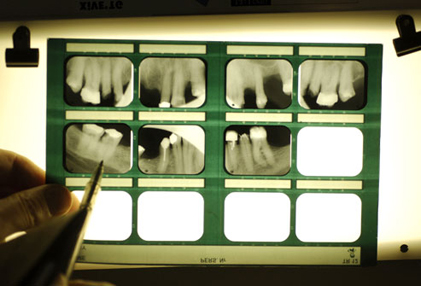5photolibrary rm photo of dental xray