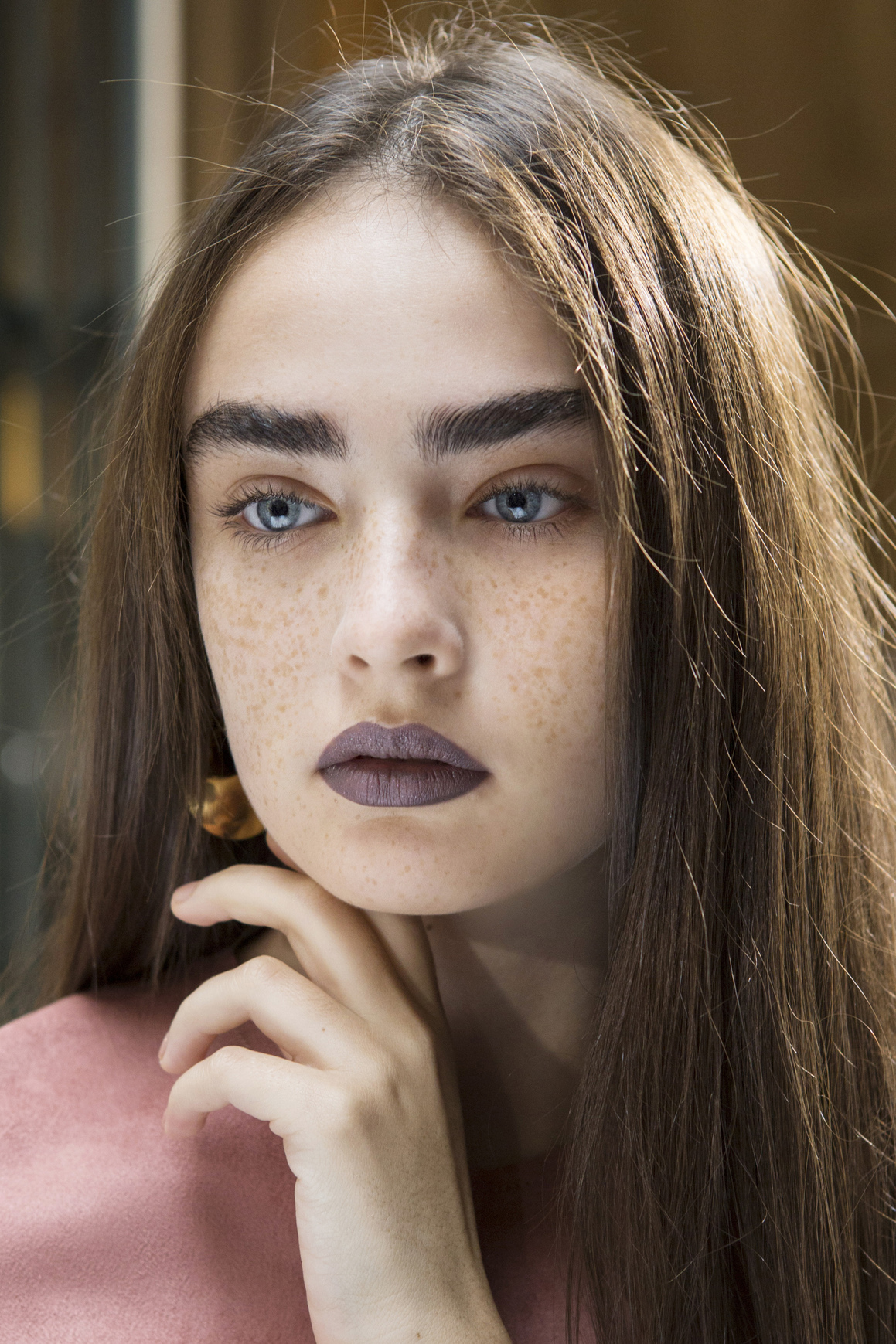 Acne bbt S17 003