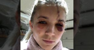 Σοκαριστικός τραυματισμός για την τερματοφύλακα της γυναικείας ομάδας της Λίβερπουλ