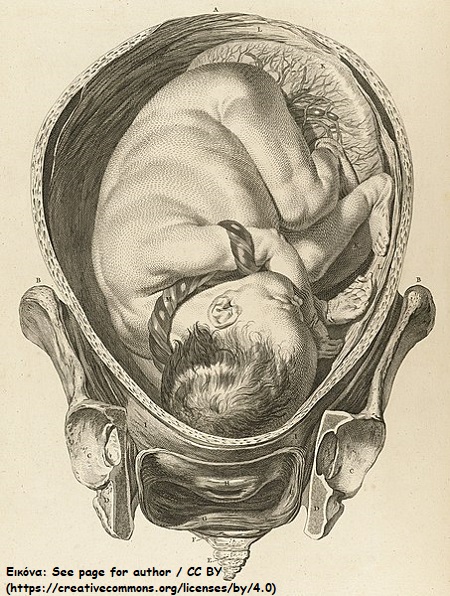 pic3