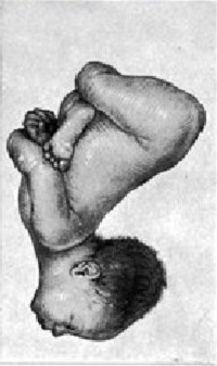 pic2