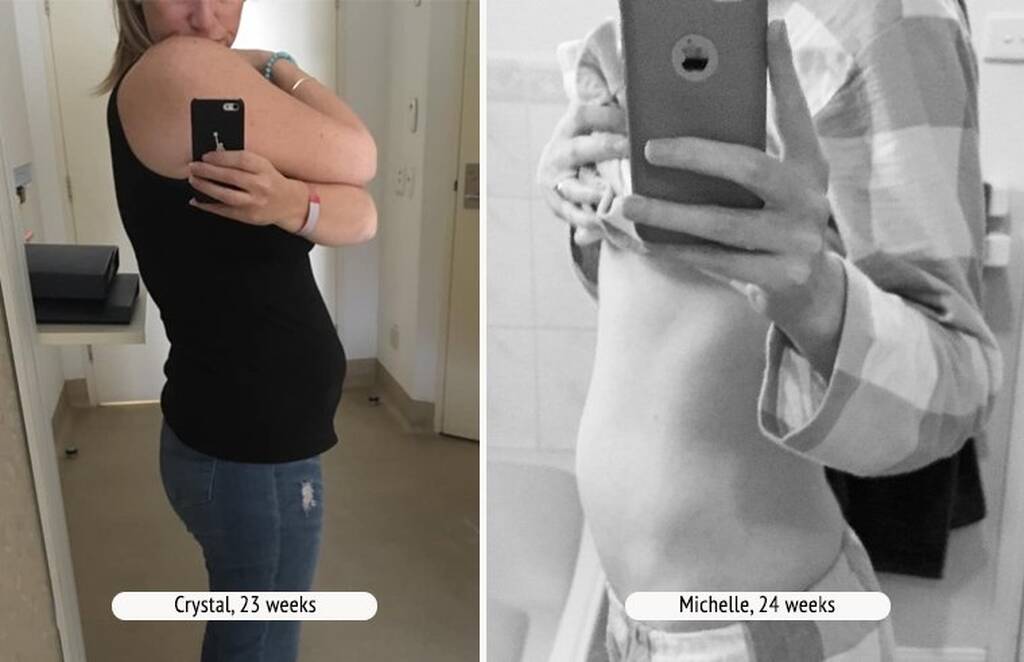 Bump shaming: Yπάρχει και πρέπει να σταματήσει αμέσως (εικόνες)