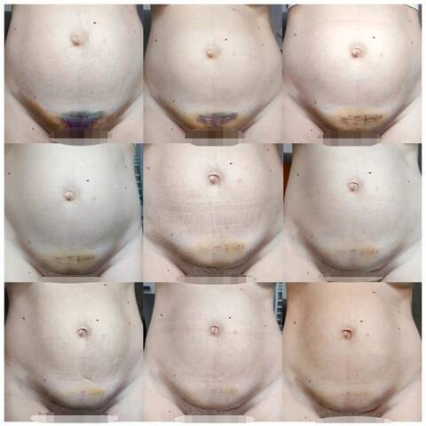 kaisariki tomi anarrosi oulis