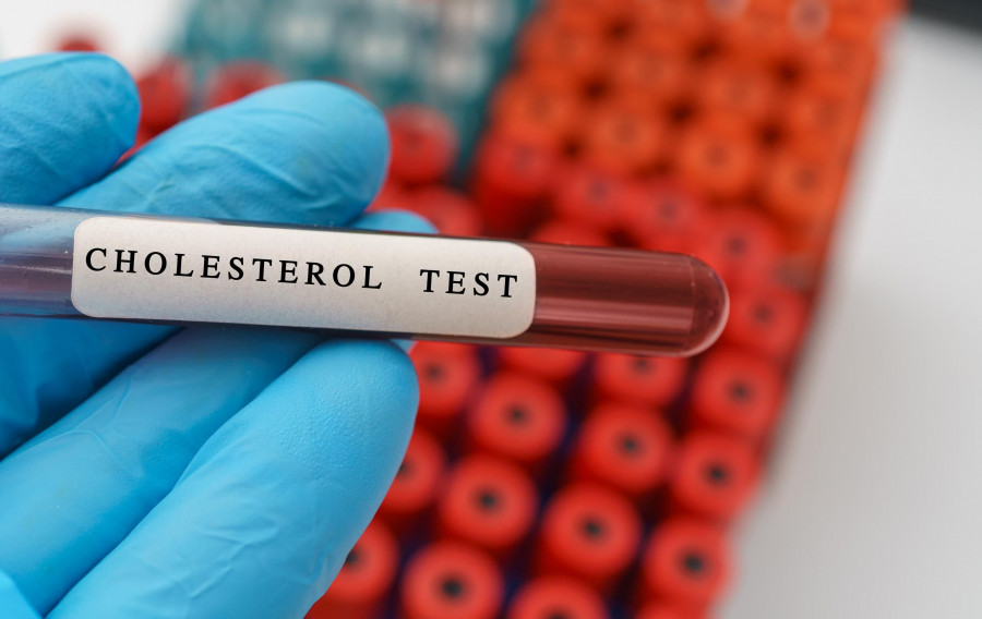 Cholesterol test result with blood sample in test tube on doctor hand in medical lab