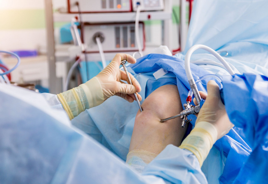 Arthroscope Surgery. Orthopedic Surgeons In Teamwork In The Operating Room