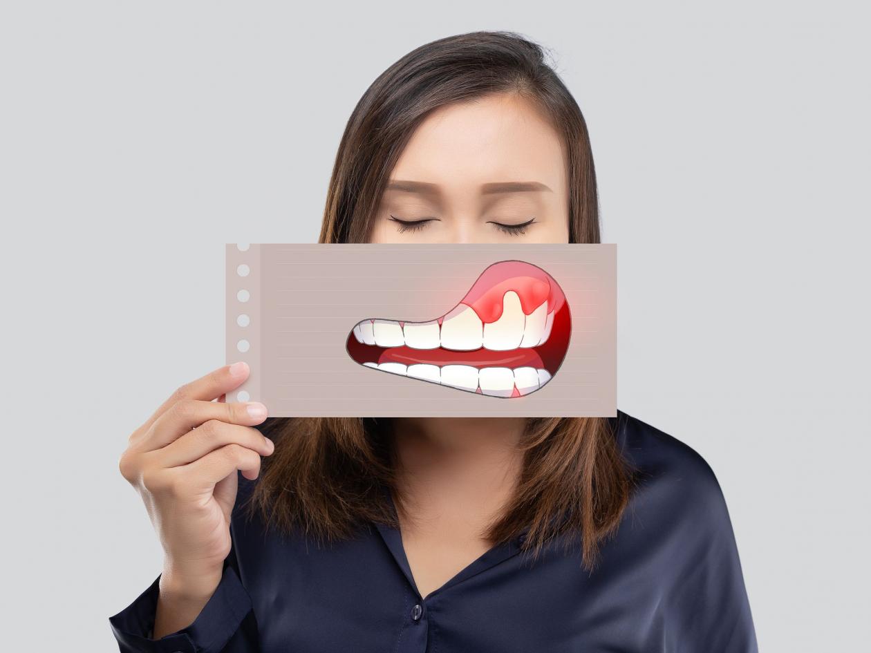 Asian Woman In The Dark Blue Shirt Holding A Paper With The Periodontal And Gingivitis Cartoon Pictu