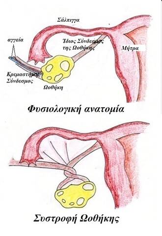 sistrofi oothikis1