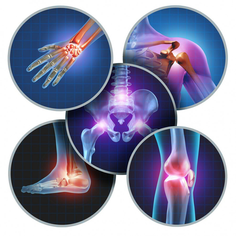 1643644988237-248809639-arthritida.jpg