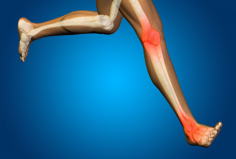 osteoporosi