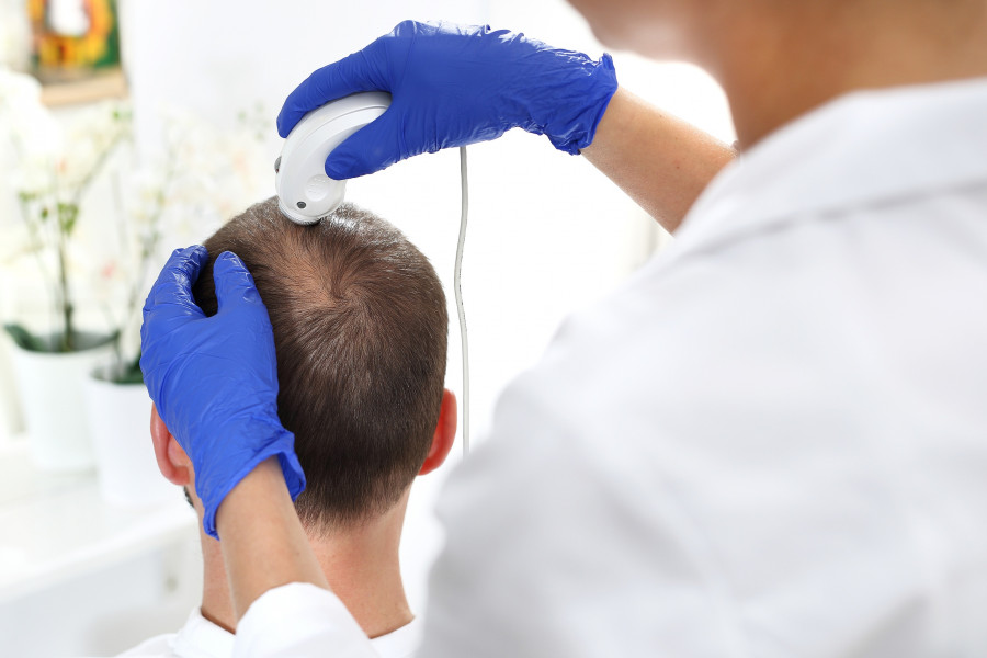 Hair-Loss-Laser-Treatment
