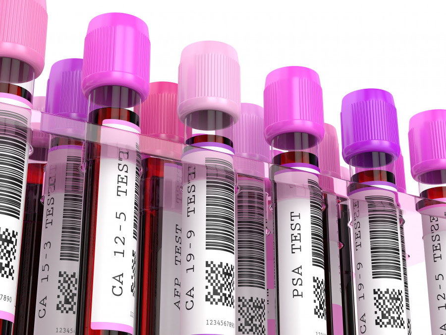 Blood-Samples-Tumor-Markers-Cancer