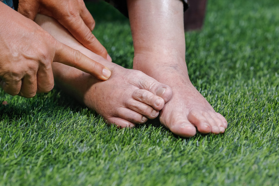 Swollen-Foot